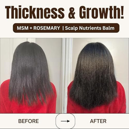 Qhemet Biologics MSM + Rosemary Scalp Nutrients Balm | Food for Hair Growth | MSM, Rosemary, Bhringraj, Castor Oil & Coconut Oil | For Dry Scalp, Thinning & Slow Growth | Vegan (4 oz) Avelisse