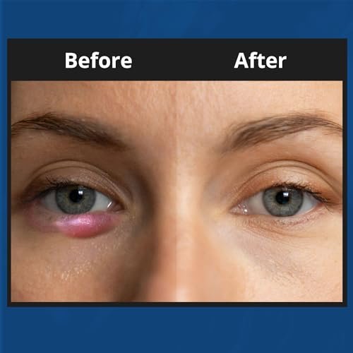 NOVEHA XStye Eyelid Foaming Cleanser – Fast Stye Relief with Tea Tree Oil, Daily Eyelid & Eyelash Wash for Dryness (3.38 fl oz / 100mL) - görsel 8