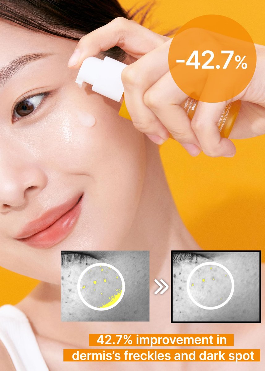 celimax Pore+Dark Spot Brightening Serum 30ml – Gel-like Pore Minimizer with Niacinamide & Tranexamic Acid for Sensitive Skin, Hyperpigmentation & Hydration Avelisse