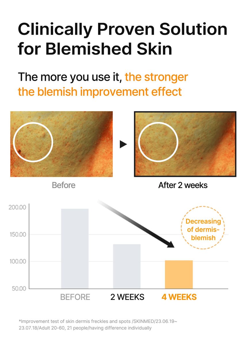 celimax Pore+Dark Spot Brightening Serum 30ml – Gel-like Pore Minimizer with Niacinamide & Tranexamic Acid for Sensitive Skin, Hyperpigmentation & Hydration Avelisse