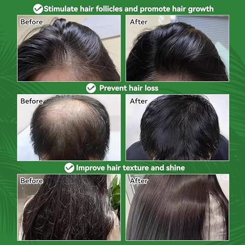 Raw Batana Oil for Hair Growth – 100% Natural, Unrefined, Pure Batana Oil – Dr. Sebi Organic Hair Oil – Prevent Hair Loss, Restore Damaged Hair & Scalp – Moisturize Scalp – 4.05 OZ - görsel 10