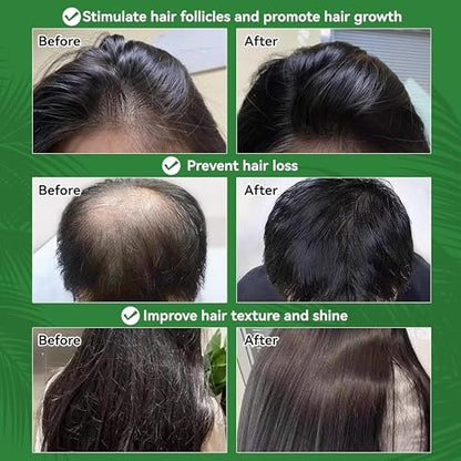 Raw Batana Oil for Hair Growth – 100% Natural, Unrefined, Pure Batana Oil – Dr. Sebi Organic Hair Oil – Prevent Hair Loss, Restore Damaged Hair & Scalp – Moisturize Scalp – 4.05 OZ