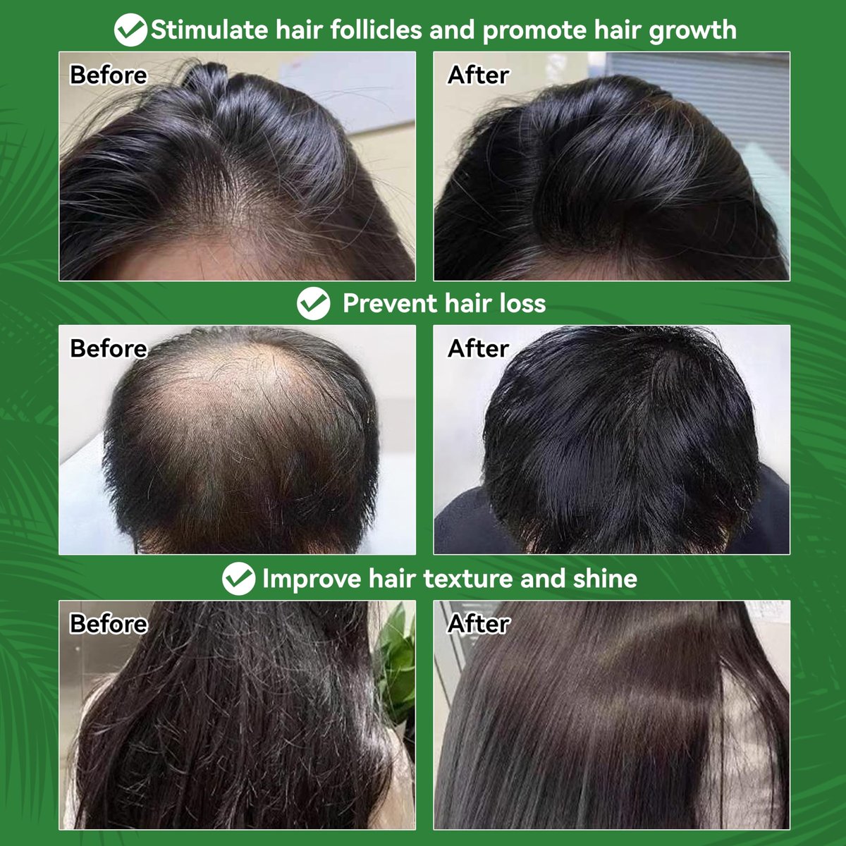 Raw Batana Oil for Hair Growth – 100% Natural, Unrefined, Pure Batana Oil – Dr. Sebi Organic Hair Oil – Prevent Hair Loss, Restore Damaged Hair & Scalp – Moisturize Scalp – 4.05 OZ - görsel 9