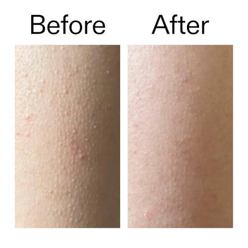 The INKEY List Glycolic Acid Exfoliating Body Stick – Deep Exfoliation for Rough, Bumpy Skin, Targets KP & Ingrown Hairs, Fragrance Free - görsel 14