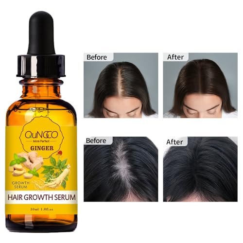 Collagen Hair Treatment Mask & Hair Growth Serum – Deep Conditioner for Dry, Damaged Hair, Natural Hair Regrowth Oil for Men & Women Avelisse