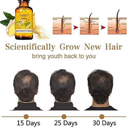 Collagen Hair Treatment Mask & Hair Growth Serum – Deep Conditioner for Dry, Damaged Hair, Natural Hair Regrowth Oil for Men & Women Avelisse