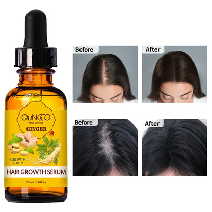 Collagen Hair Treatment Mask & Hair Growth Serum – Deep Conditioner for Dry, Damaged Hair, Natural Hair Regrowth Oil for Men & Women Avelisse
