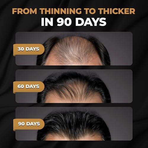 SPARTAN™ Root Activator Shampoo For Men - Hair Growth Shampoo for Hair Loss and Thinning Hair Avelisse
