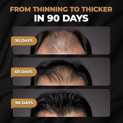 SPARTAN™ Root Activator Shampoo For Men - Hair Growth Shampoo for Hair Loss and Thinning Hair Avelisse