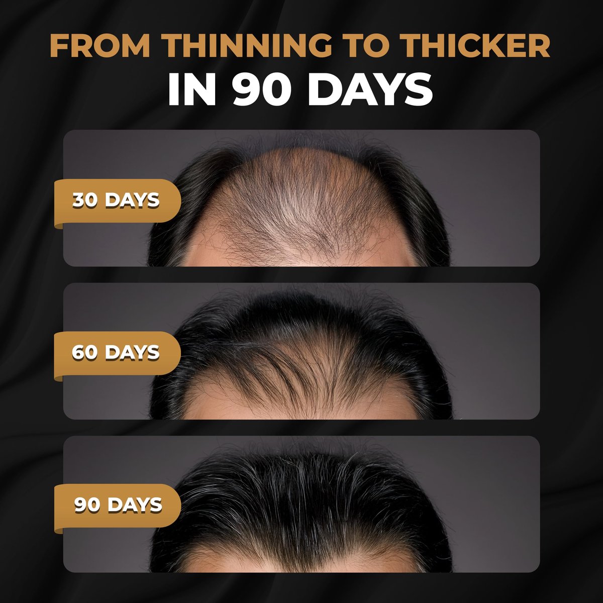 SPARTAN™ Root Activator Shampoo For Men - Hair Growth Shampoo for Hair Loss and Thinning Hair Avelisse