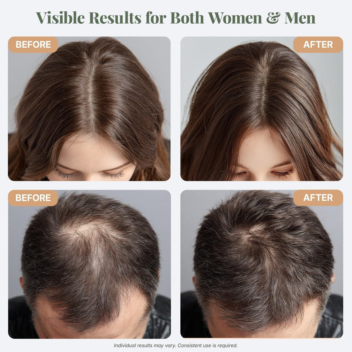 The ÉLIX USDA Organic Rosemary Oil for Hair Growth | Thickening Formula with Castor & Pumpkin Seed | for Hair Loss & Thinning | Made in USA | 4oz Avelisse