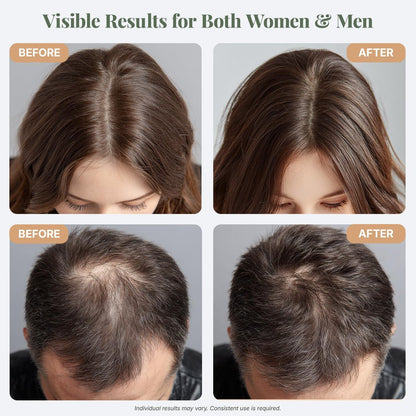 The ÉLIX USDA Organic Rosemary Oil for Hair Growth | Thickening Formula with Castor & Pumpkin Seed | for Hair Loss & Thinning | Made in USA | 4oz Avelisse