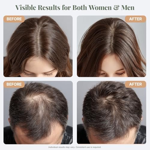 The ÉLIX USDA Organic Rosemary Oil for Hair Growth | Thickening Formula with Castor & Pumpkin Seed | for Hair Loss & Thinning | Made in USA | 4oz Avelisse