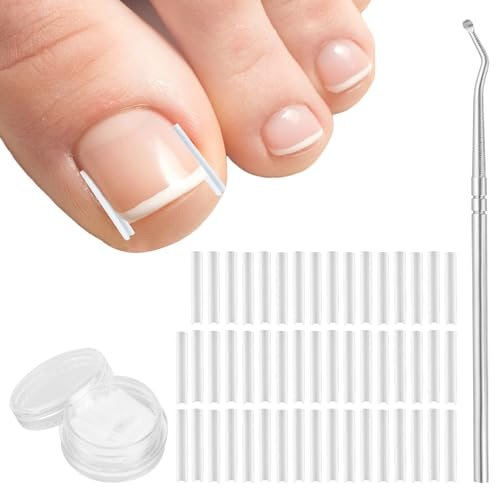 50+1 Ingrown Toenail Corrector Treatment Set - Professional Pain-Free Removal Kit with Toenail Lifter and Straightener Strips for Men and Women - görsel 1