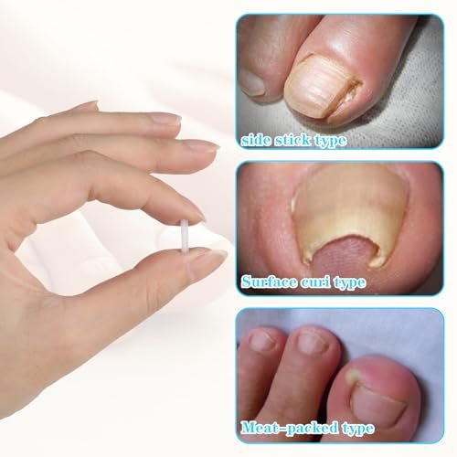 50+1 Ingrown Toenail Corrector Treatment Set - Professional Pain-Free Removal Kit with Toenail Lifter and Straightener Strips for Men and Women - görsel 7