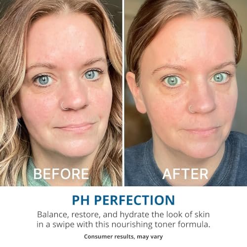 goPure Hit Refresh Hydrating Toner – Balanced pH, Clarifies Pores, Removes Excess Oil & Impurities – 4 Fl Oz Avelisse
