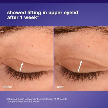 Dermalogica Phyto Nature Lifting Eye Cream - Anti-Aging Serum for Fine Lines and Wrinkles Avelisse