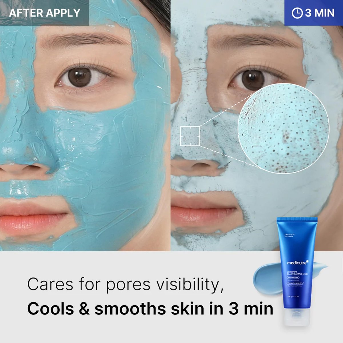 Medicube Zero Pore Blackhead Mud Facial Mask - Cooling Pore Tightening 3-Minute Quick Dry Formula with AHA, BHA, PHA & Purifying Clay - Korean Mud Mask 3.52 oz Avelisse