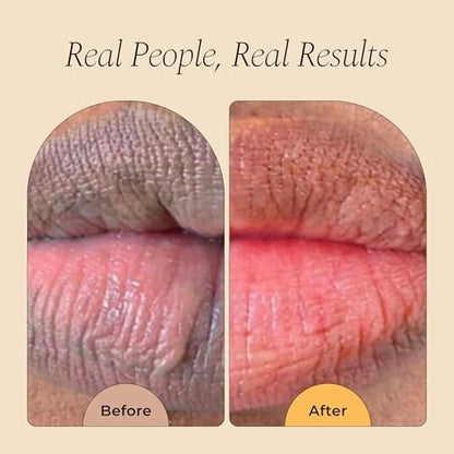 Glo Melanin All Natural Lemon and Turmeric Lip Balm – Illuminate Your Smile, Brighten & Nourish Dark Lips Effortlessly