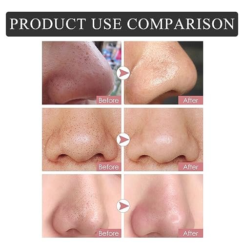 Caunmy Blackhead Remover Nose Pore Strips - Deep Cleansing & Moisturizing Clear-Up Strips for Blackheads, 20 Count, Unisex - görsel 7
