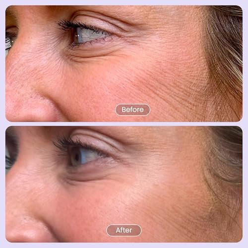 BOOST 100% Pure Volufiline Serum - Instant Plumping Hydration Facial Serum for Visibly Plumper Skin - Anti-Aging Ampoule for Loss of Volume - Korean Skincare for Face, Neck & Décolleté, 0.5 Fl Oz - görsel 16