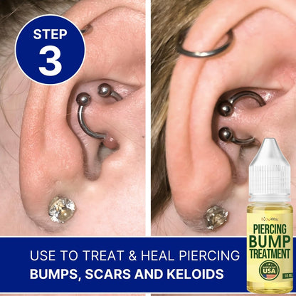 BodyJ4You Piercing Aftercare Spray - Keloid Bump Removal & Piercing Hole Cleaner | Natural Saline Wound Wash for Ears, Nose & Body Piercings