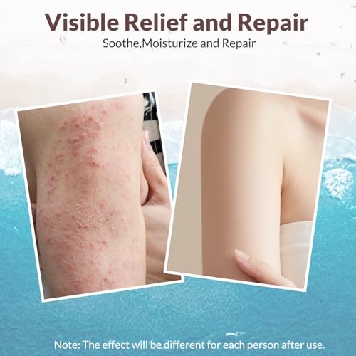 Crogooe Natural Soothing Eczema Cream – Fragrance-Free Moisturizer for Dry, Itchy & Sensitive Skin with Sea Moss, Aloe Vera & Oats, 4 oz Avelisse