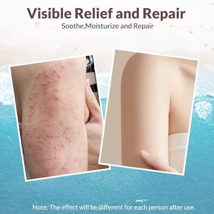 Crogooe Natural Soothing Eczema Cream – Fragrance-Free Moisturizer for Dry, Itchy & Sensitive Skin with Sea Moss, Aloe Vera & Oats, 4 oz Avelisse