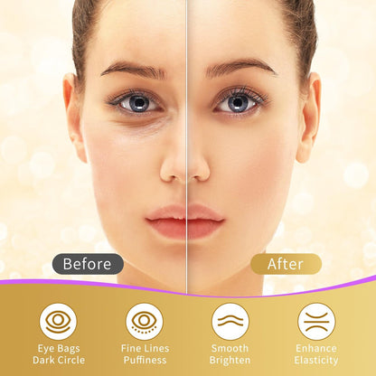 USTELIR Under Eye Patches – 40 Pairs 24K Gold Eye Mask for Dark Circles, Puffy Eyes, Wrinkles & Under-Eye Bags – Skin Care Treatment for Men & Women