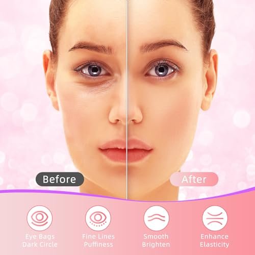 USTELIR Under Eye Patches 40 Pairs - Rose Infused Eye Mask for Dark Circles, Puffy Eyes, Bags, and Wrinkles - Eye Treatment Skin Care for Men & Women - görsel 8