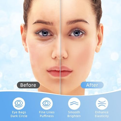 USTELIR Under Eye Patches – 40 Pairs Eye Mask for Dark Circles, Puffy Eyes, Undereye Bags & Wrinkles with Hyaluronic Acid – Eye Treatment Skin Care for Men & Women