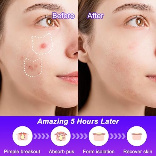 CELECARE Cat Pimple Patches - 120 Cute Acne Patches with Salicylic Acid & Tea Tree, Hydrocolloid Dots for Face, 20 Colors Avelisse