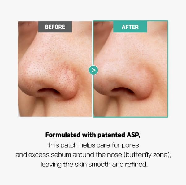 SLLIGHT Centella Poreless Patches – Hydrocolloid Nose Patches for Blackhead Removal & Sebum Control with Centella Asiatica | Korean Skincare | 8 Count - görsel 6