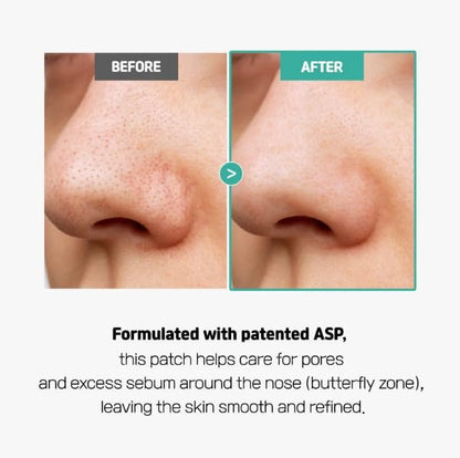 SLLIGHT Centella Poreless Patches – Hydrocolloid Nose Patches for Blackhead Removal & Sebum Control with Centella Asiatica | Korean Skincare | 8 Count