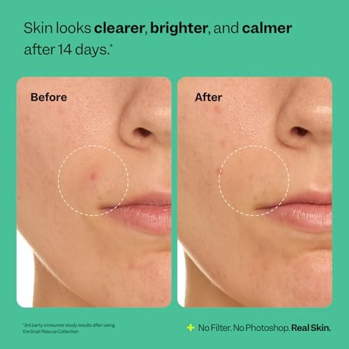 Peach Slices Snail Rescue Purifying Cleanser - Snail Mucin Face Wash with Pine Bark, Hyaluronic Acid & Cica - Korean Skin Care, 4.05 oz - görsel 12