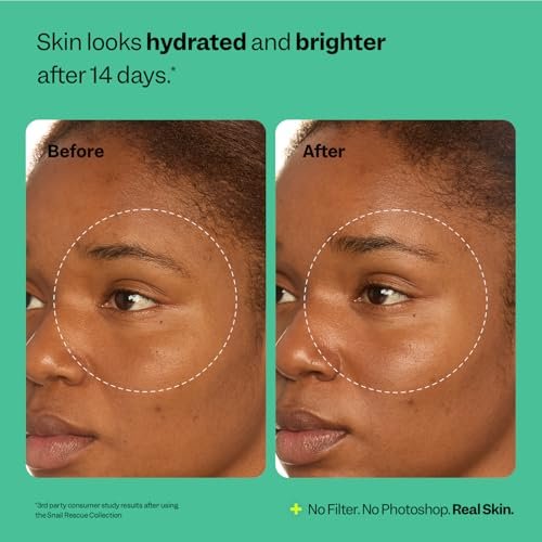 Peach Slices Snail Rescue All-in-One Deep Moisture Cream - Intensive Hydration with Snail Mucin, Squalane & Hyaluronic Acid - 2.82 oz - Clean, Cruelty-Free Korean Skincare - görsel 12