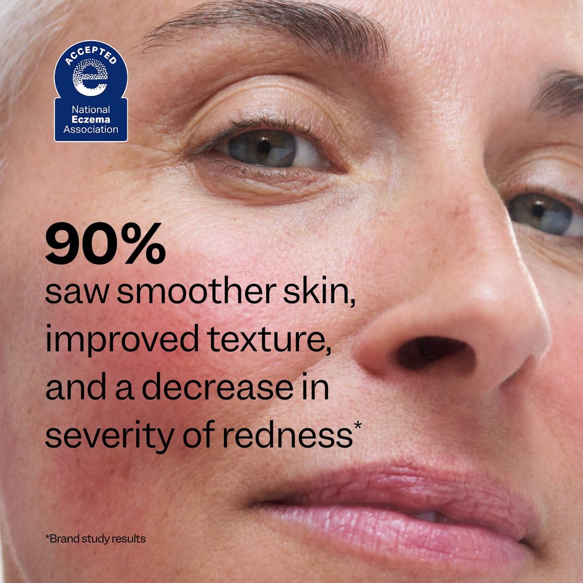 Peach Slices Redness Relief 10% Azelaic Acid Serum – Vegan, Cruelty-Free Korean Skincare for Redness & Acne Avelisse