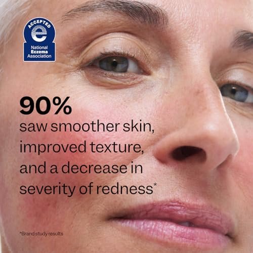 Peach Slices Redness Relief 10% Azelaic Acid Serum – Vegan, Cruelty-Free Korean Skincare for Redness & Acne Avelisse