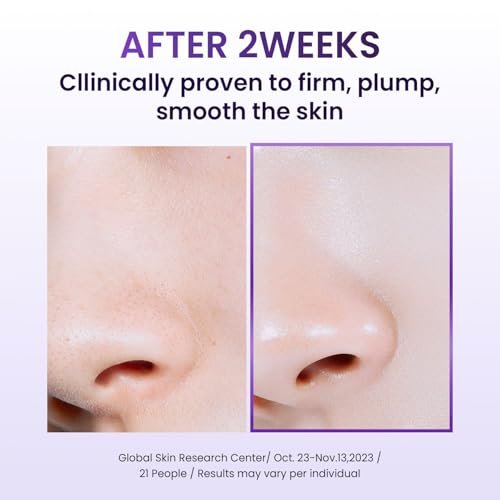 BIOHEAL BOH Probioderm™ Collagen Remodeling Cream – Pore Tightening & Firming Moisturizer with 150,000 Collagen Capsules, 1.69 fl oz Avelisse