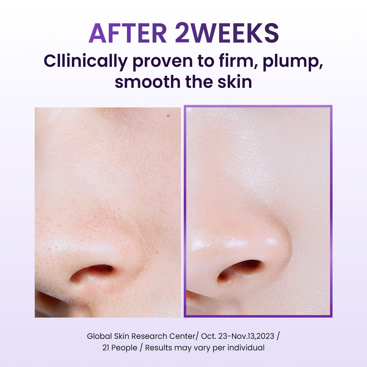 BIOHEAL BOH Probioderm™ Collagen Remodeling Cream – Pore Tightening & Firming Moisturizer with 150,000 Collagen Capsules, 1.69 fl oz Avelisse