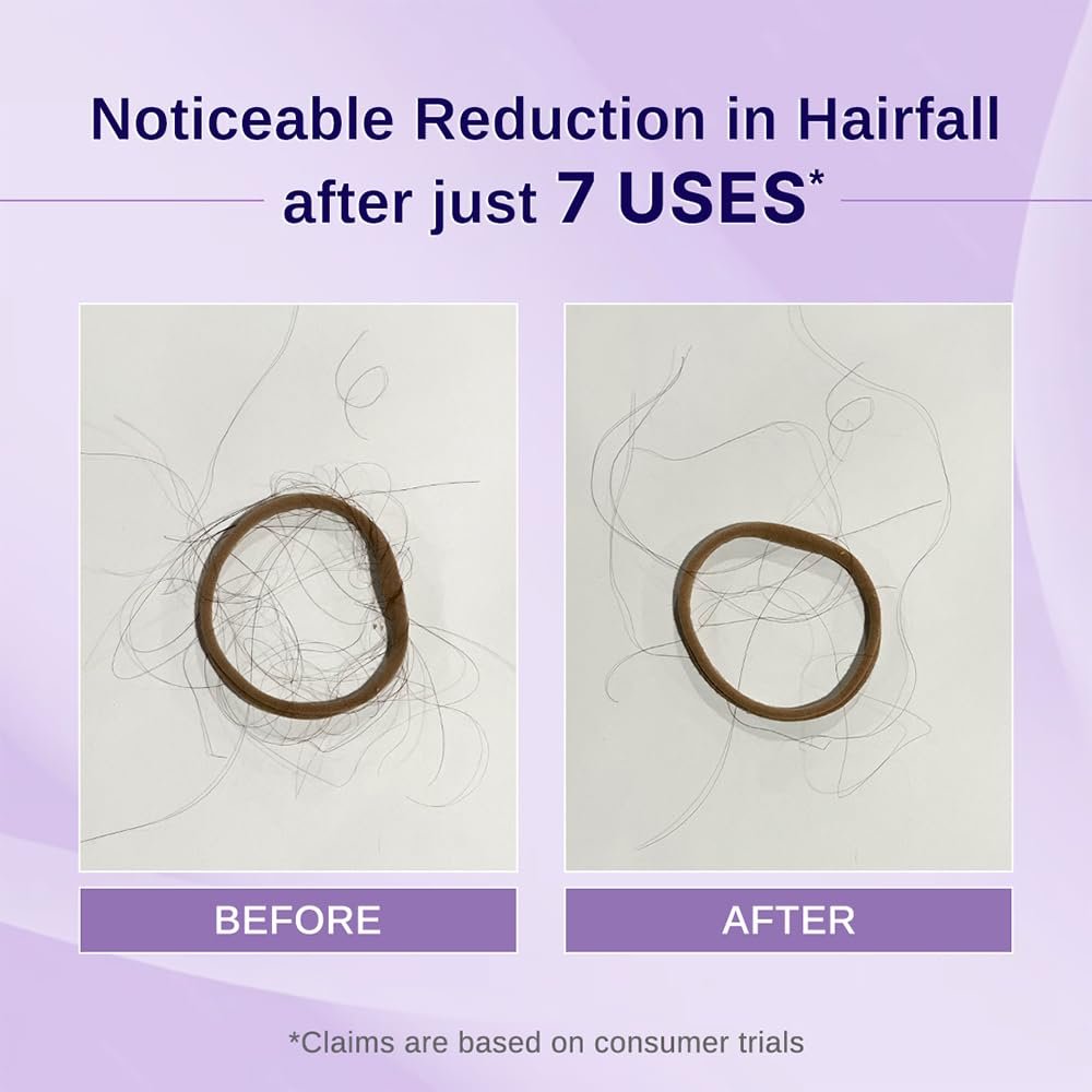 Bare Anatomy Nature x Science Rosemary Hibiscus Hair Growth Oil for Women & Men - Helps Hair Growth & Strengthens Hair, Nourishes Scalp & Controls Hair Fall, Suitable for All Hair Types - 100ml - görsel 5
