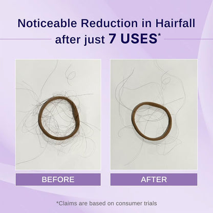 Bare Anatomy Nature x Science Rosemary Hibiscus Hair Growth Oil for Women & Men - Helps Hair Growth & Strengthens Hair, Nourishes Scalp & Controls Hair Fall, Suitable for All Hair Types - 100ml