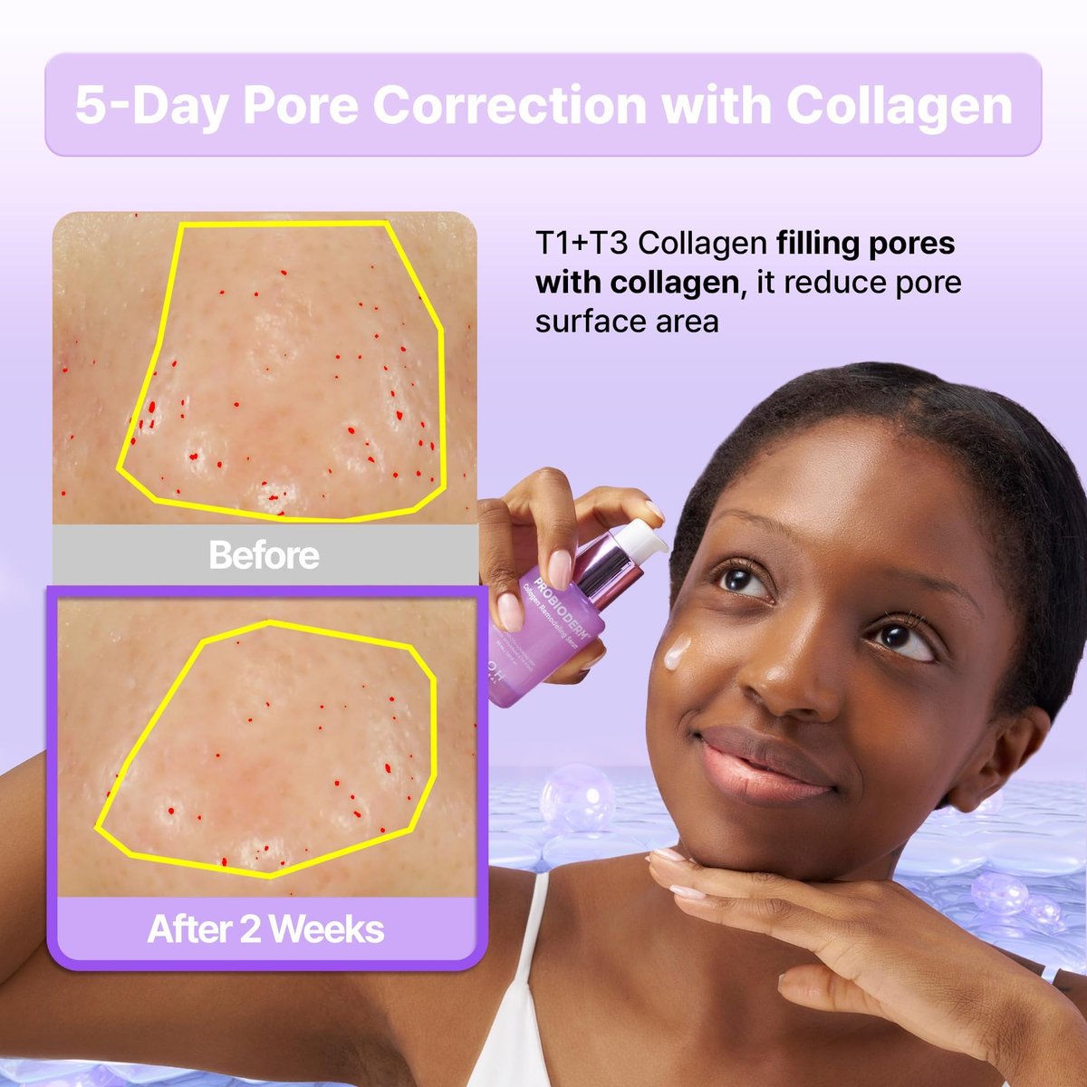 BIOHEAL BOH Probioderm™ Collagen Remodeling Serum - Skin Firming & Pore Tightening with Collagen & 12 Peptides, 1.01 fl oz - görsel 5