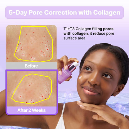 BIOHEAL BOH Probioderm™ Collagen Remodeling Serum - Skin Firming & Pore Tightening with Collagen & 12 Peptides, 1.01 fl oz