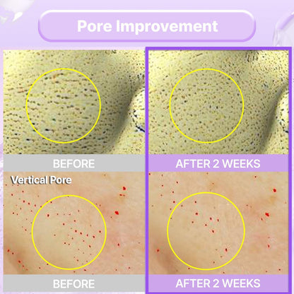 BIOHEAL BOH Probioderm™ Collagen Remodeling Serum - Skin Firming & Pore Tightening with Collagen & 12 Peptides, 1.01 fl oz