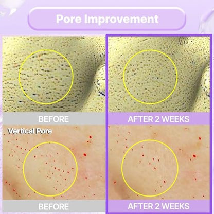 BIOHEAL BOH Probioderm™ Collagen Remodeling Serum - Skin Firming & Pore Tightening with Collagen & 12 Peptides, 1.01 fl oz