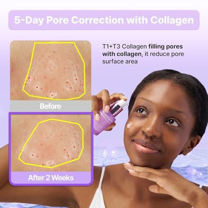 BIOHEAL BOH Probioderm™ Collagen Remodeling Serum - Skin Firming & Pore Tightening with Collagen & 12 Peptides, 1.01 fl oz