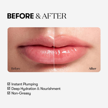 VT COSMETICS Reedle Shot Lip Plumper - Hydrating & Volumizing Clear Lip Gloss with Microneedling Effect & Hyaluronic Acid for Fuller, Smoother Lips (Beginner, 0.15 oz)