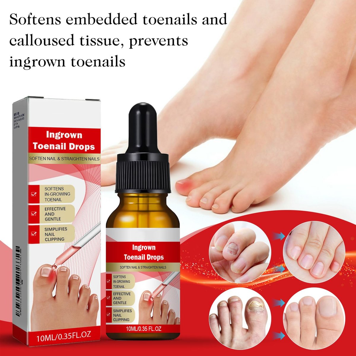 2-Pack Ingrown Toenail Drops & Relief Kit with Silicone Gel Toe Caps | AUJ Avelisse