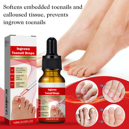 2-Pack Ingrown Toenail Drops & Relief Kit with Silicone Gel Toe Caps | AUJ Avelisse